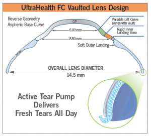 UH-FC Vaulted Lens Design